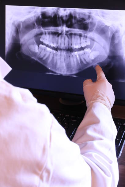 Best Walk-In Emergency Dentist in San Carlos, TX